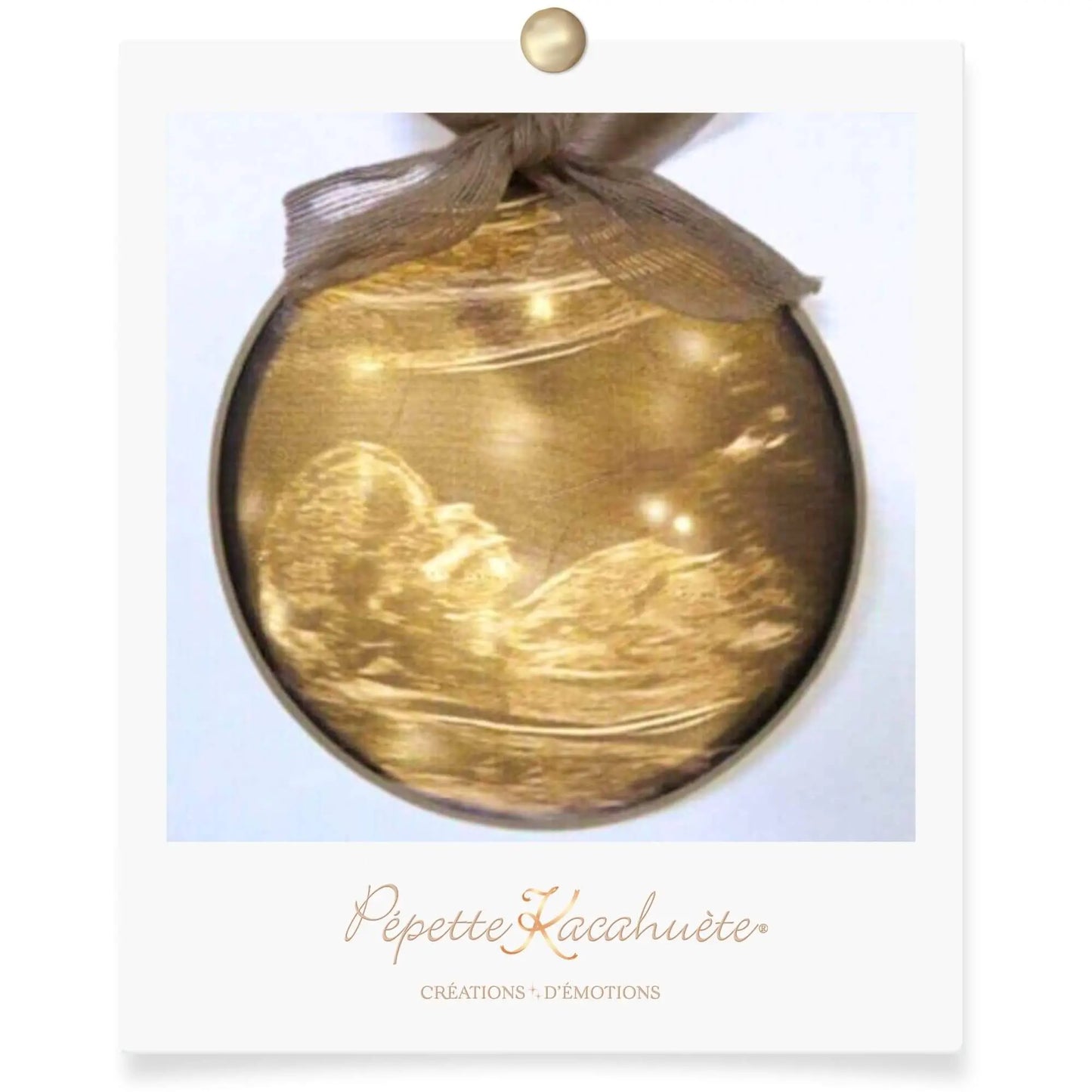 CERCLE LUMINEUX ECHOGRAPHIE