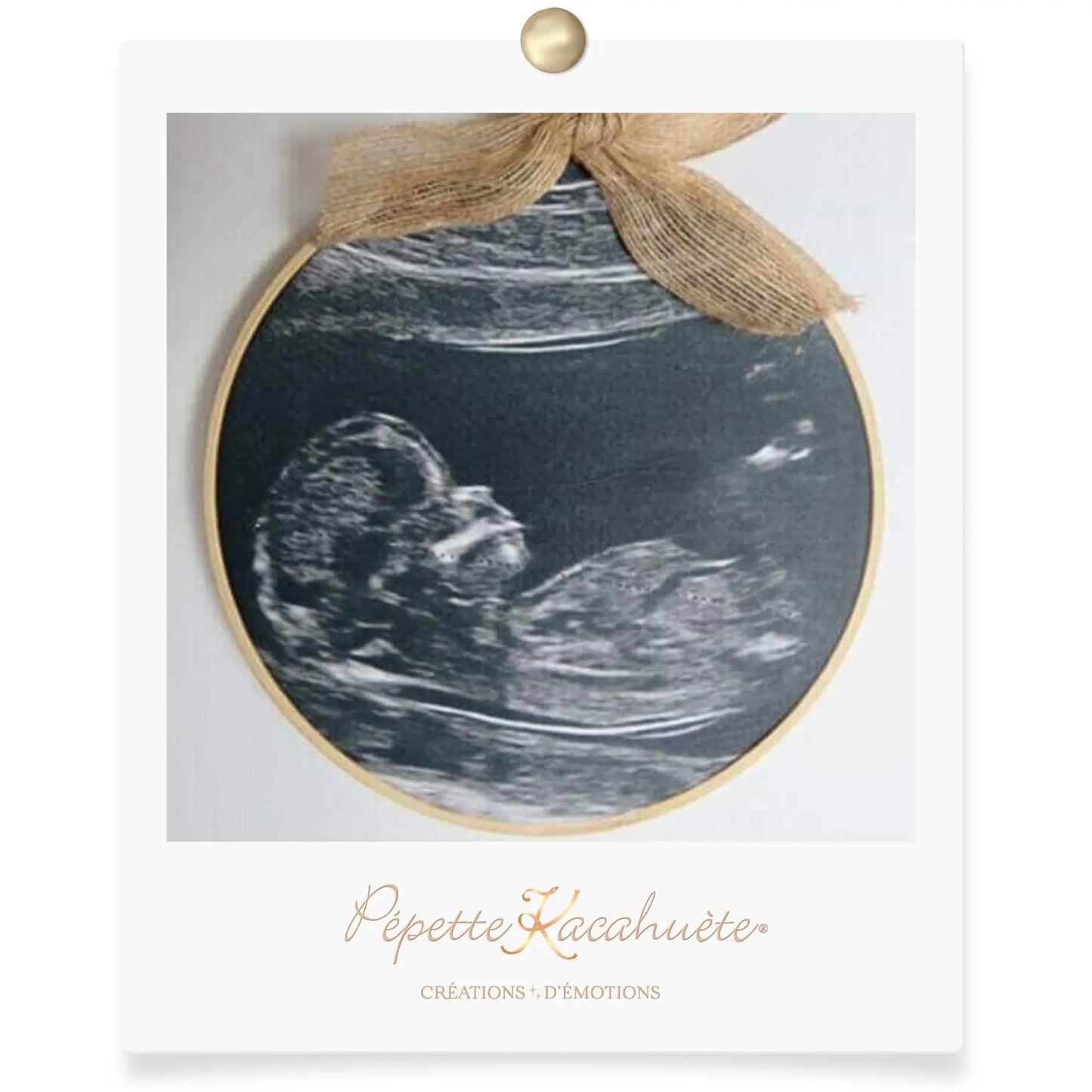 CERCLE LUMINEUX ECHOGRAPHIE