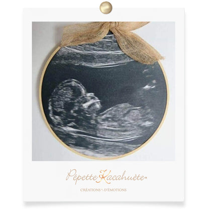 CERCLE LUMINEUX ECHOGRAPHIE